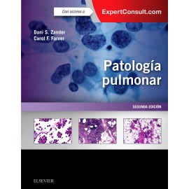 Patología pulmonar + ExpertConsult (ebook)