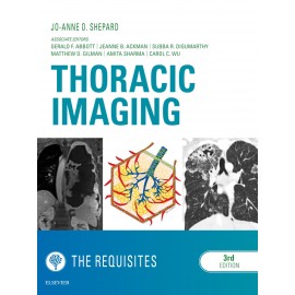 Thoracic Imaging The Requisites E-Book (ebook)