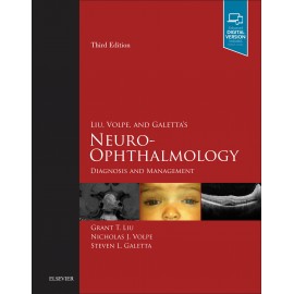 Liu, Volpe, and Galetta?s Neuro-Ophthalmology E-Book (ebook)