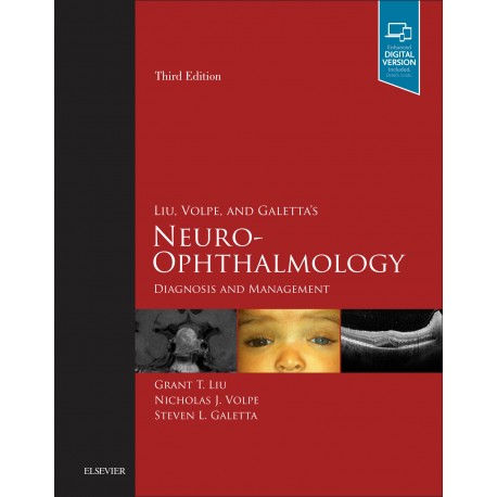 Liu, Volpe, and Galetta?s Neuro-Ophthalmology E-Book (ebook) - Envío Gratuito