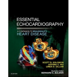 Essential Echocardiography: A Companion to Braunwald?s Heart Disease E-Book (ebook)