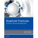 Scaphoid Fractures (ebook) - Envío Gratuito