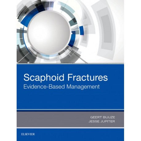 Scaphoid Fractures (ebook) - Envío Gratuito