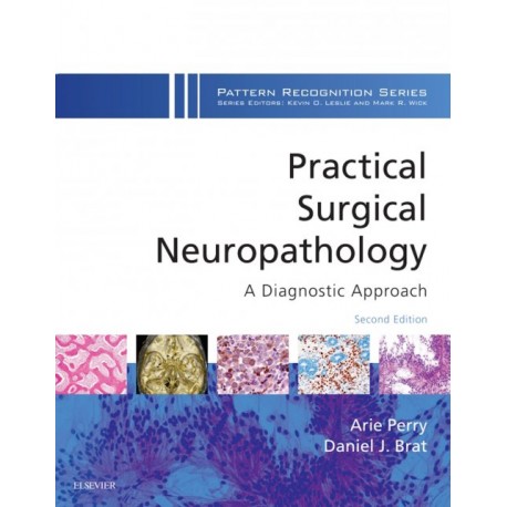 Practical Surgical Neuropathology: A Diagnostic Approach E-Book (ebook) - Envío Gratuito