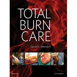 Total Burn Care E-Book (ebook)