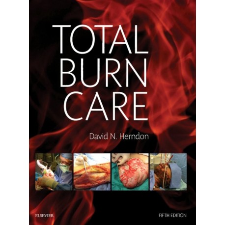 Total Burn Care E-Book (ebook) - Envío Gratuito