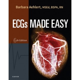 ECGs Made Easy - E-Book (ebook)