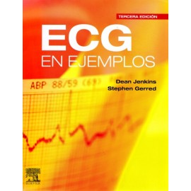 ECG en ejemplos - Envío Gratuito