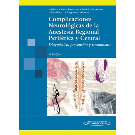 Complicaciones neurológicas de la anestesia regional periférica y central - Envío Gratuito