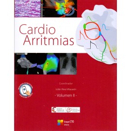 Cardio arritmias 2 volúmenes
