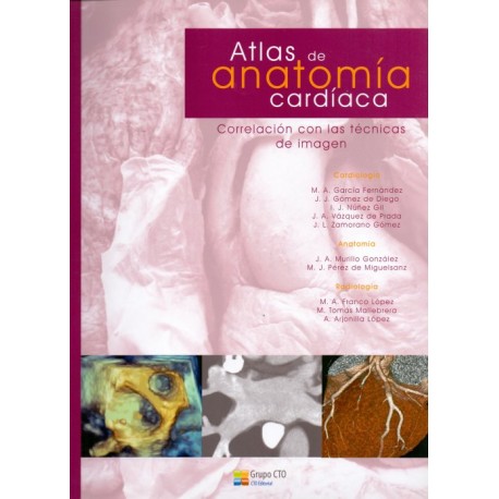 Atlas de anatomía cardiaca. Correlación con las técnicas de imagen - Envío Gratuito