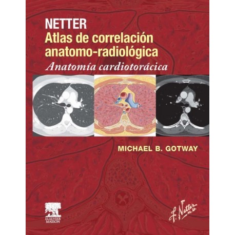 Netter. Atlas de correlación anatomo-radiológica: Anatomía cardiotorácica - Envío Gratuito