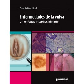 Enfermedades de la vulva en enfoque interdisciplinario - Envío Gratuito