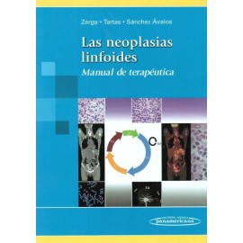 Las neoplasias linfoides. Manual de terapéutica - Envío Gratuito