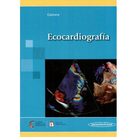 Ecocardiografía - Envío Gratuito