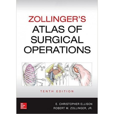 Zollinger. Atlas of Surgical Operations - Envío Gratuito