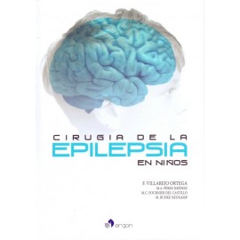 Cirugía de la Epilepsia en Niños