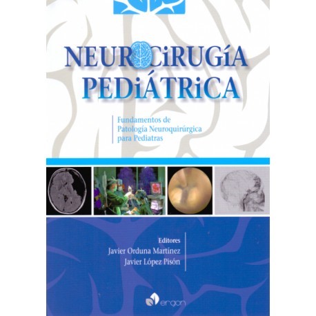 Neurocirugía pediátrica. Fundamentos de patología neuroquirúrgica para pediatras Ergon - Envío Gratuito