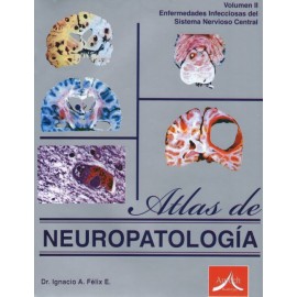 Atlas de neuropatología Vol. II: Enfermedades infecciosas del sistema nervioso central - Envío Gratuito