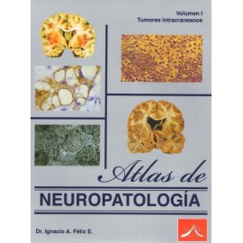 Atlas de neuropatología Vol. I: Tumores intracraneanos - Envío Gratuito