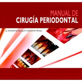 Manual de cirugía periodontal - Envío Gratuito