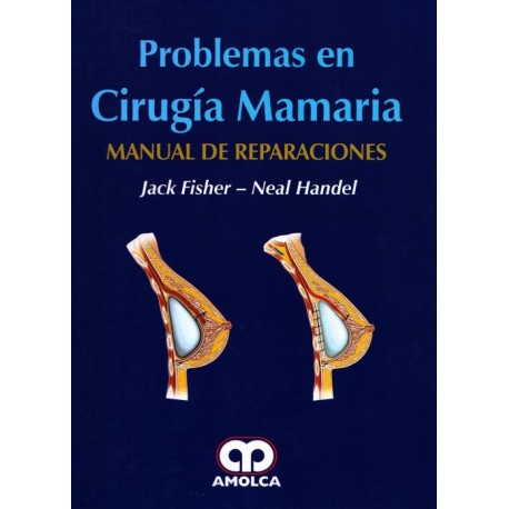 Problemas en Cirugía Mamaria. Manual de reparaciones - Envío Gratuito