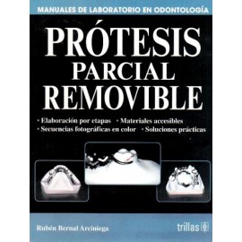 Prótesis parcial removible serie: Manuales de laboratorio en odontología - Envío Gratuito