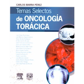 Temas selectos de oncología torácica - Envío Gratuito