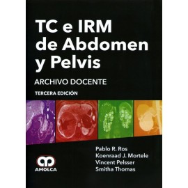 TC e IRM de Abdomen y Pelvis - Envío Gratuito