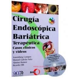 Cirugía Endoscópica Bariátrica Terapéutica Casos Clínicos y Videos