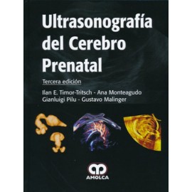 Ultrasonografía del cerebro prenatal - Envío Gratuito