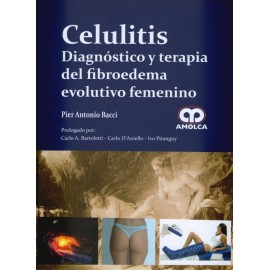 Celulitis Amolca