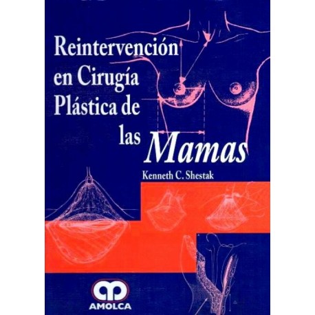 Reintervención en cirugía plástica de las mamas Amolca - Envío Gratuito