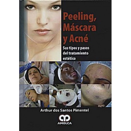 Peeling, Máscara y Acné Amolca - Envío Gratuito