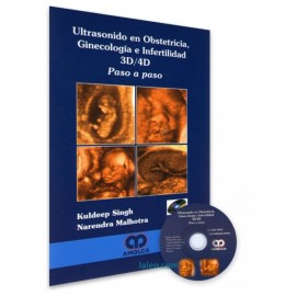 Ultrasonido en Obstetricia, Ginecología e Infertilidad 3D/4D. Paso a Paso + CD