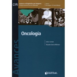 Avances en Diagnóstico por Imágenes: Oncología
