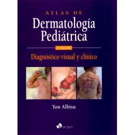 Atlas de dermatología pediátrica
