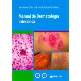 Manual de Dermatología infecciosa